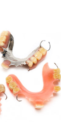 Extracție dinți incluși
