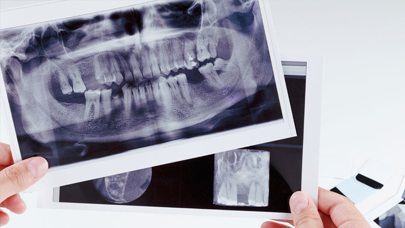 Radiologie dentară